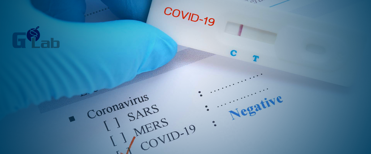 test_pcr_maroc_glab_covid_19-laboratoire_casablanca Information d&eacute;pistage COVID19 par RT &ndash; PCR pour les personnes d&eacute;sirant se d&eacute;placer &agrave; l&rsquo;&eacute;tranger.